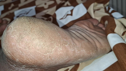 The Pig Has Big Legs and Asked a Cuckold to Come Lick the Cuckold Album Available There